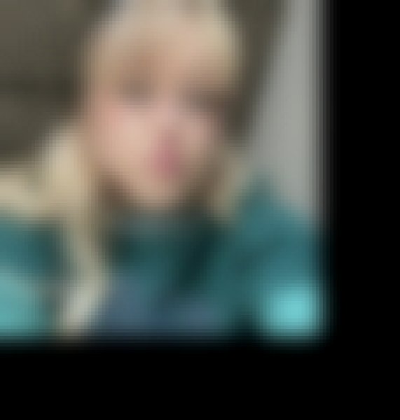 Allison D, 35, Bruchkbel